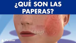 Image result for Sialoadenitis