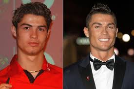 Как живет роналду в 2019? Plasticheskie Operacii Chto Uluchshili V Sebe Zvezdnye Futbolisty Beauty Doctor