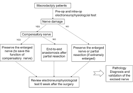 Using stapling devices for intestinal anastomosis may offer advantages over traditional hand suturing. Morphological And Neurophysiological Impairment Of The Nerve In Type Ii Macrodactyly