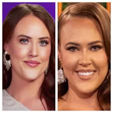 Heather Gay's transformation and femininity after plastic surgery