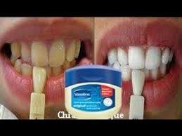 In Soli 2 Minuti Trasforma I Denti Gialli In Bianco Perla E Lucidi Sbiancamento Den Sbiancamento Naturale Dei Denti Sbiancare I Denti Sbiancamento Dei Denti