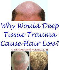 Yes, low levels of vitamin b12 can give rise to hair issues. Pin On Hair Loss Remedy