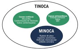 Os principais causadores dessa doença são vírus. Questoes Em Cardiologia Photos Facebook