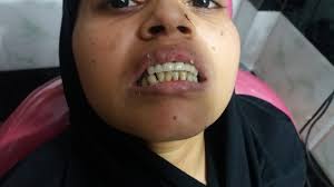 List of nearest Orthodontist Doctors For Clear Aligners in Shiv Vihar,  Delhi