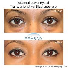 Image result for Blepharis transvaalensis