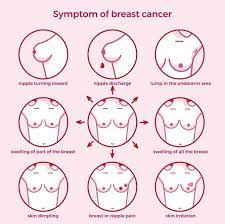 Women with these abnormal genes also have an increased likelihood of developing ovarian cancer. Nhs Dorset Clinical Commissioning Group Make Sure You Re Aware Of The Signs And Symptoms Of Breast Cancer And That You Check Your Breasts Regularly Speak To Your Gp If You Notice