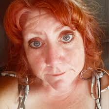 Gastric bypass after amputation for weight loss?