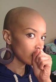 Wear your hair in cornrows, box braids, or other styles that put tension on the hair and scalp. Follow Black Women Natural Hairstyles Bald Women Bald Hair Natural Hair Styles For Black Women