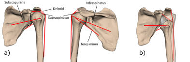 With 120 degrees of unassisted flexion, the shoulder joint is the most mobile joint in the body. A Shoulder Muscles B Reverse Shoulder Implant Pre Transparent Download Scientific Diagram