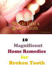 Home Remedies Care 10 Magnificent Home Remedies For Broken Tooth Broken Tooth Cracked Tooth Broken Tooth Repair