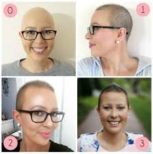 Jessica, who was diagnosed with breast cancer in 2009, talks about her experience with chemotherapy and describes how the hair loss affected her. Hair Growth Styling Tips For Short Hair After Chemo My Cancer Chic Hair Growth After Chemo Chemo Hair Hair Growth