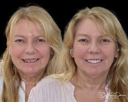 I think we made a small difference