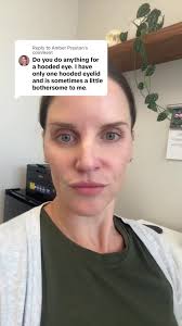 Replying to @Amber Preston #hoodedeyes #eyelift #browlift #ptosis