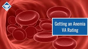 Image result for Anemia