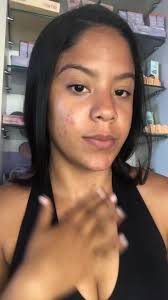 Rotina de Cuidados para Pele Oleosa e Acneica