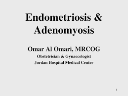 This is especially true for human beings. Ppt Endometriosis Adenomyosis Powerpoint Presentation Free Download Id 6527393