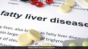 Fatty Liver Diet Symptoms Causes Diet Tips And Foods To