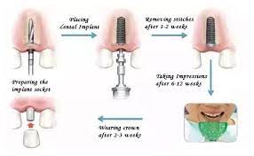 Pin On Cosmetic Dentistry
