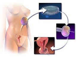 After nearly a year of trying, she was starting to think about seeing her doctor for fertility testing when she took a pregnancy test and saw the two pink lines she'd. In Vitro Fertilisation Wikipedia