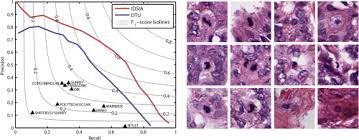 (explaining how this detector works is beyond the scope of this. Assessment Of Algorithms For Mitosis Detection In Breast Cancer Histopathology Images Sciencedirect