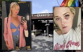 The Abbey Failkan Saman Terhadap Wanita Yang Dakwa Diberi Dadah Oleh  Bartender : r/LosAngeles