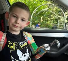 Eight-year-old boy receives custom Lego prosthetic arm