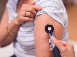 Knowing which one you have will inform your doctor's treatment recommendations. Psoriasis Vs Skin Cancer Pictures Knowing The Signs And More