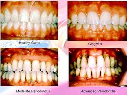 11 reviews of klinik pergigian kempas klinik kesihatan kempas adalah salah satu daripada kemudahan penduduk yang berdekatan dan berhampiran di kawasan kempas. Oyxt0svpg Qjum