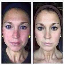 Lisa Villalobos-Menuey, Independent Brand Partner, Nerium International