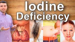 Keep track of your symptoms and if you have concerns, please contact your doctor. 8 Symptoms Of Iodine Deficiency Hair Loss Weight Gain Constipation Feeling Tired And A Dry Skin Youtube