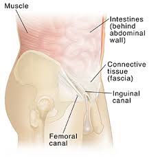 While some hard or pea sized lumps can be normal and mostly goes away on their own. Anatomy Of The Abdomen And Groin Saint Luke S Health System