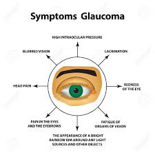 Severe eye and head pain. Symptoms Of Glaucoma World Glaucoma Day The Anatomical Structure Royalty Free Cliparts Vectors And Stock Illustration Image 117674554