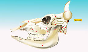 Image result for Temporal Bone