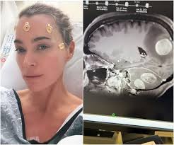 Teddi Mellencamp Diagnosed with Multiple Brain Tumors