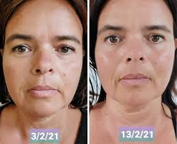 Pupa гель для бровей пигментированный eyebrow plumping gel. Face Yoga Before And After Images Face Yoga Australia