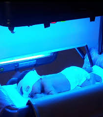 Demam kuning ditandai dengan demam tinggi dan jaundice, sebuah kondisi dimana tubuh dan mata berwarna kuning. Rawatan Fototerapi Di Rumah Untuk Bayi Kuning Mudah Jimat Berkesan Ieyra Com