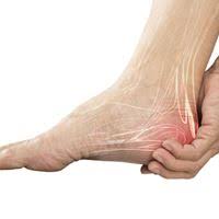Dans le cas d'un tendon d'achille sain, les fibres musculaires sont orientées de manière à répondre aux contraintes imposées au muscle. Aponevrosite Plantaire Complications Et Traitement Naturel De L Aponevrosite