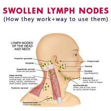 Lymphatic Drainage Ginger Roots Oil 50 Off Limited Time Sale Deals O Saur Lymphatic Drainage Massage Lymph Nodes Swollen Lymph Nodes