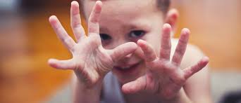 Hand Foot And Mouth Disease North Central Health District North Central Health District