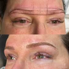 Xquisite Med Spa, York