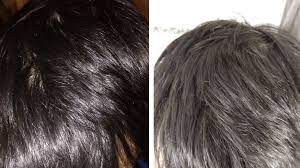 Results so far indicate that both the 1% and 2% dosages have hair loss benefits; Hair Loss Prevention For Men Date Vietnamese Girls