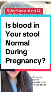 Image result for Blood in stool