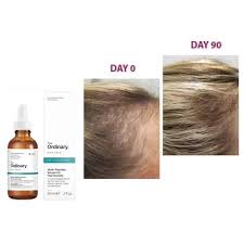 We did not find results for: The Ordinary Multi Peptide Hair Serum For Hair Density Hair Growth Strength Polypeptide Scalp Ordinary Serum Hair Care Hair Loss Thinning Hair Buy Online At Best Prices In Bangladesh Daraz Com Bd