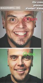 Eloy Mora mostró cómo ha cambiado su rostro gracias a los avances  tecnológicos