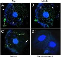 ECP production was detected by confocal microscopy in urine ...