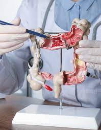 colon-content-img | Austin Gastroenterology