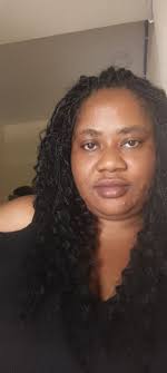 My face right now, too many breakouts,🙆 I do not understand the sudden  growth of many pimples