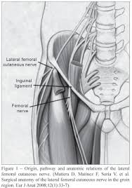 Meralgia paresthetica (mp) is a problem with the lateral femoral cutaneous nerve (lfcn). Scielo Brasil Meralgia Parestesica Secundaria A Laparoscopia Cirurgica Para Miomectomia Relato De Caso Meralgia Parestesica Secundaria A Laparoscopia Cirurgica Para Miomectomia Relato De Caso