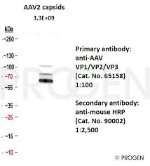 Image result for Black 1996 AAV