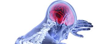 Hipoxia Cerebral Causas Sintomas Y Factores De Riesgo Dacer Centro De Neurorrehabilitacion Y Dano Cerebral